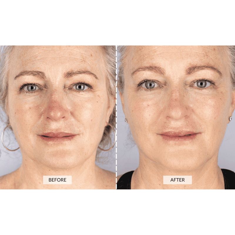 Face Toning Devices UK