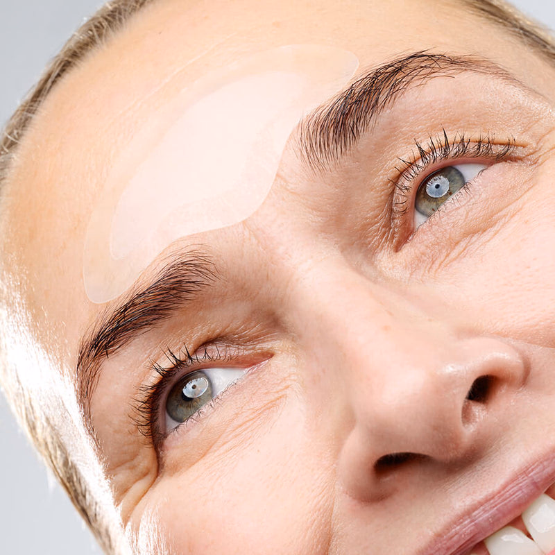 Forehead Microneedling Patch - Image 2
