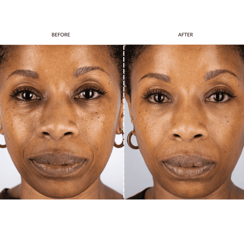 Face Toning Devices UK