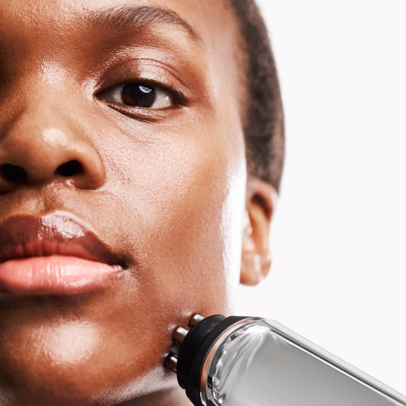 RF Radio Frequency Skin Tightening Device - Image 2